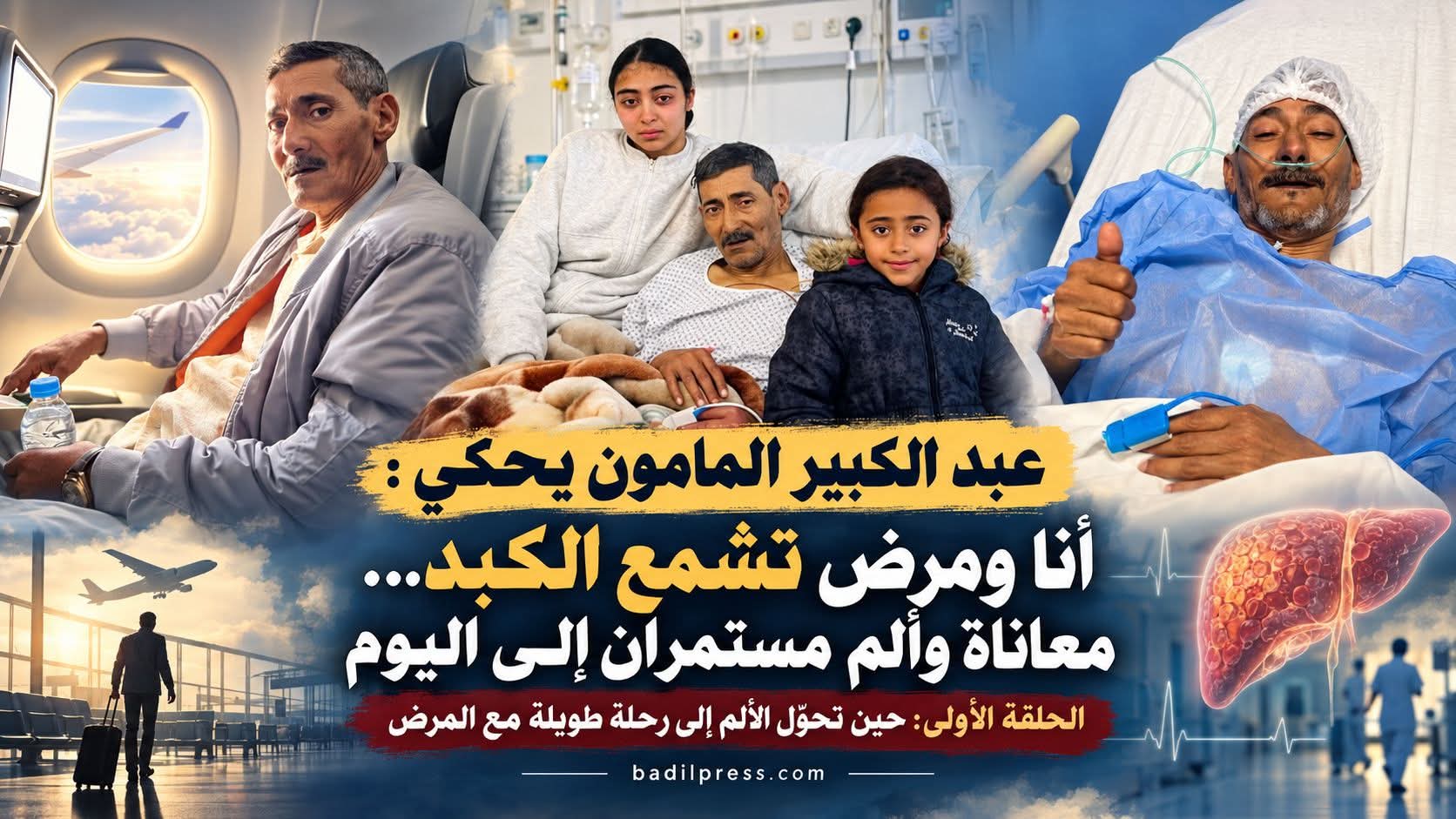 عبد الكبير المامون يحكي : أنا ومرض تشمع الكبد… معاناة وألم مستمران إلى اليوم